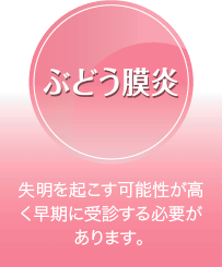 ぶどう膜炎